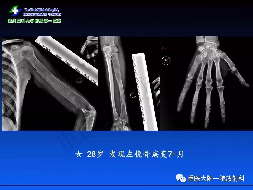 写在大地上的诗 视频主图