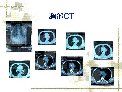 假小子 产品图片